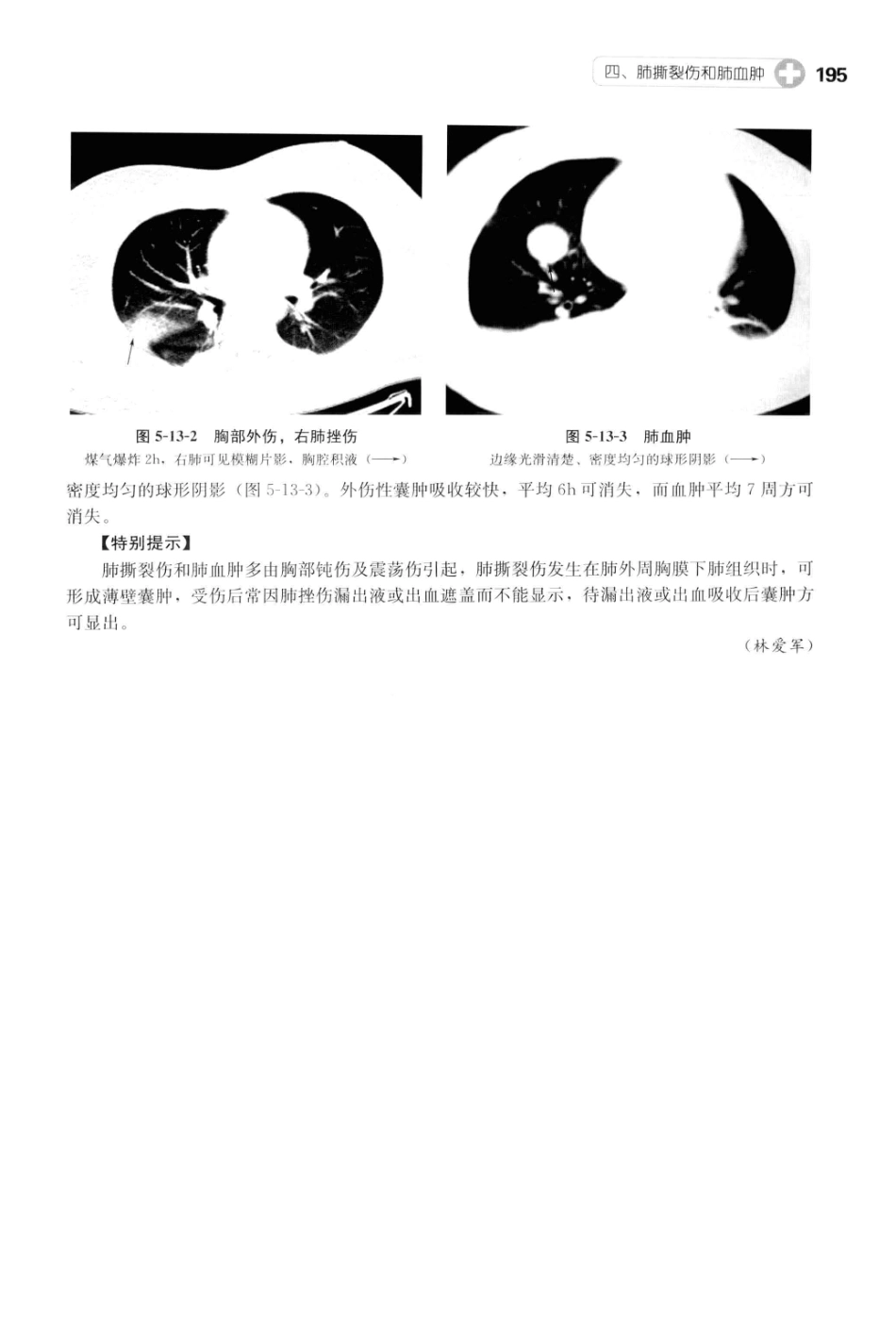 CT读片指南_13200549_206-246.pdf_第3页