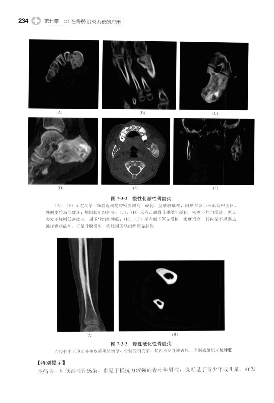 CT读片指南_13200549_247-287.pdf_第1页