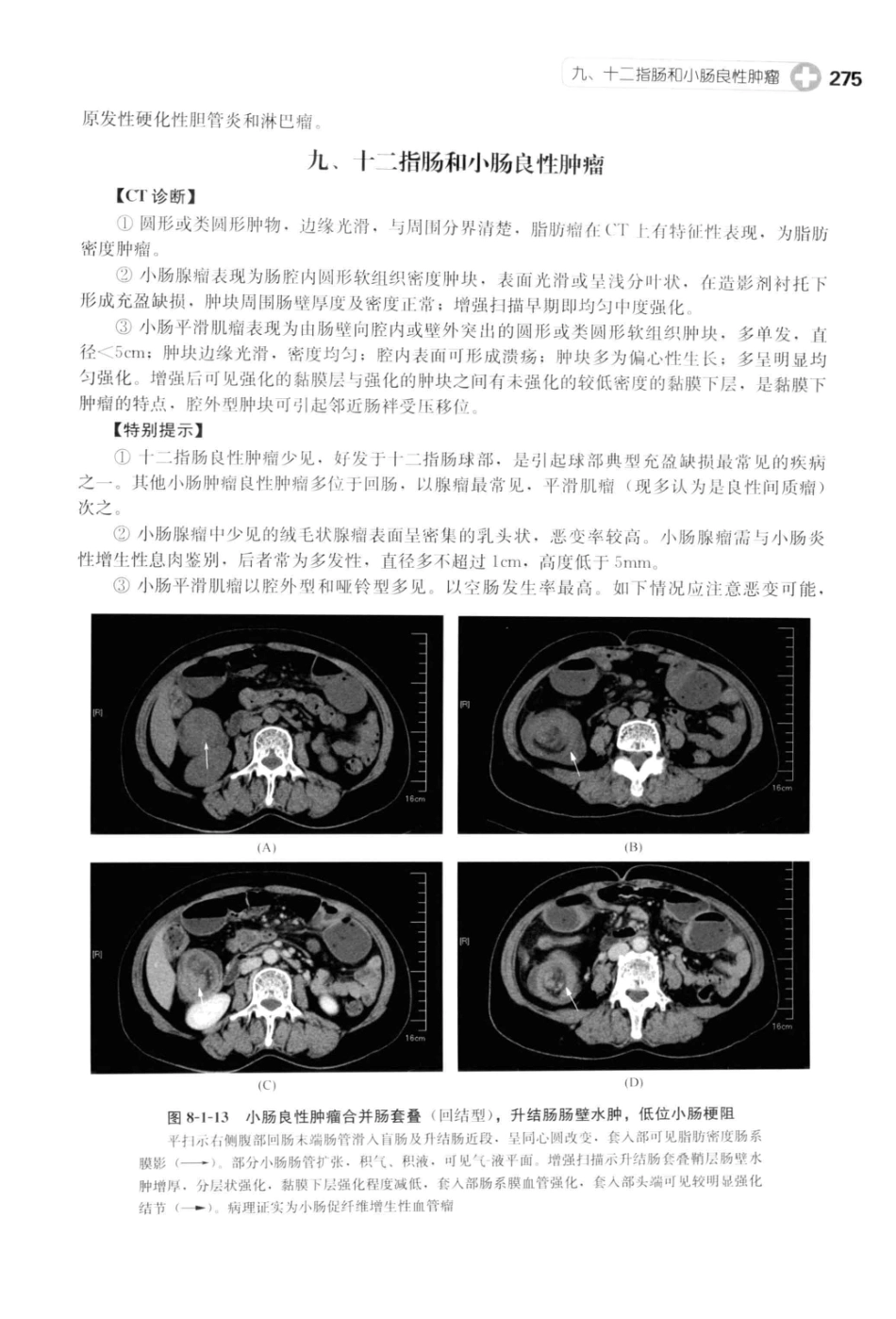 CT读片指南_13200549_288-328.pdf_第1页