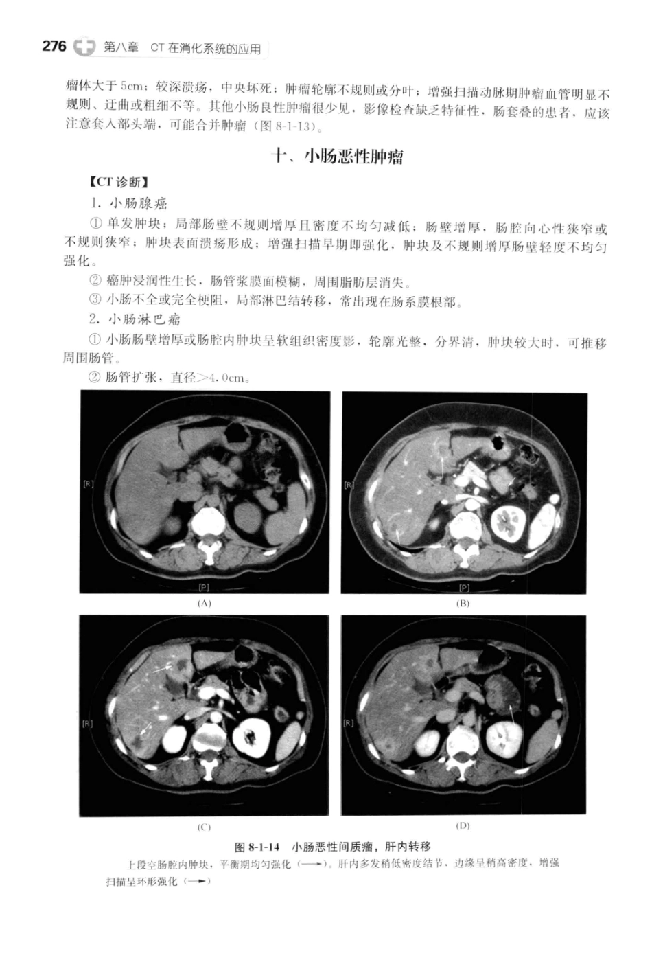 CT读片指南_13200549_288-328.pdf_第2页