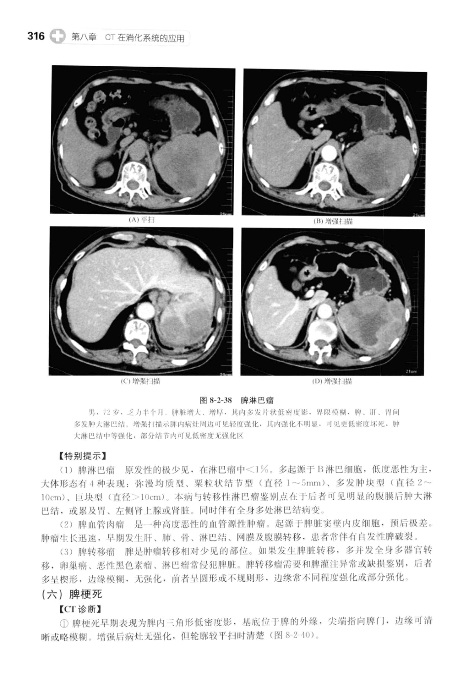 CT读片指南_13200549_329-369.pdf_第1页