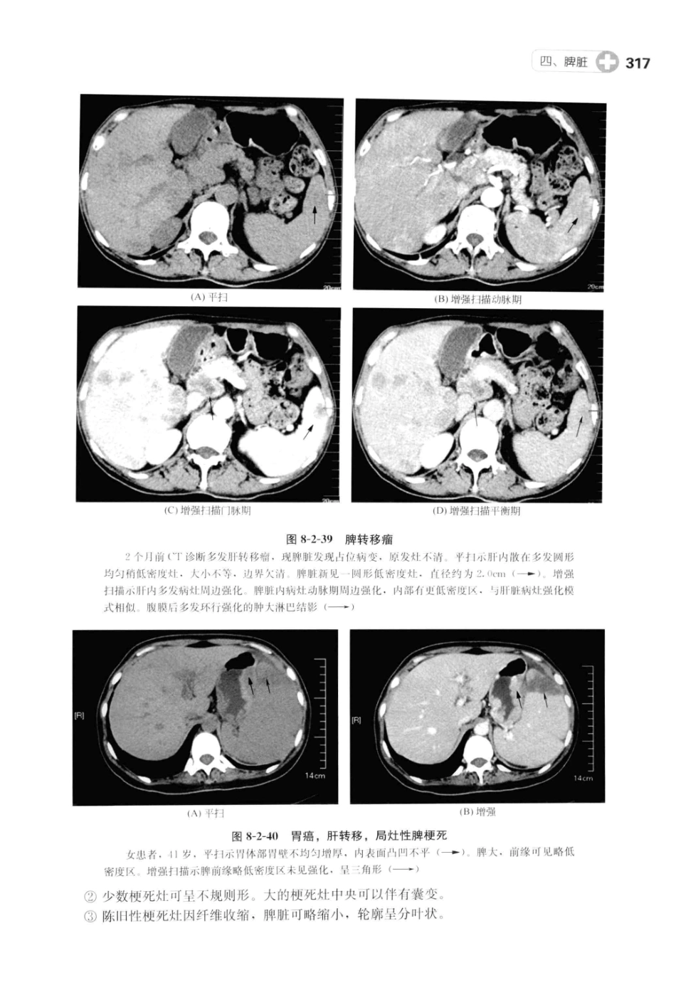 CT读片指南_13200549_329-369.pdf_第2页