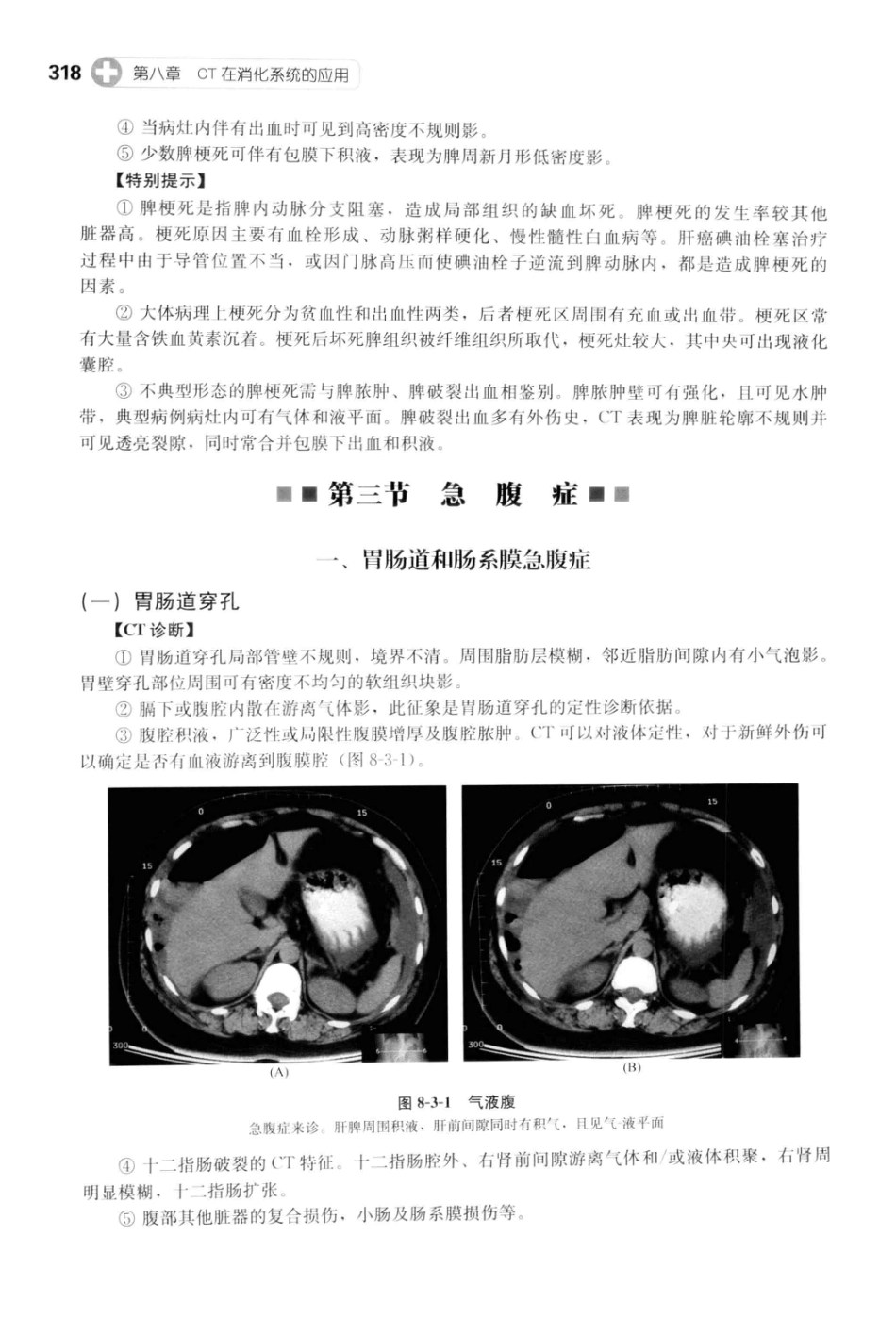 CT读片指南_13200549_329-369.pdf_第3页