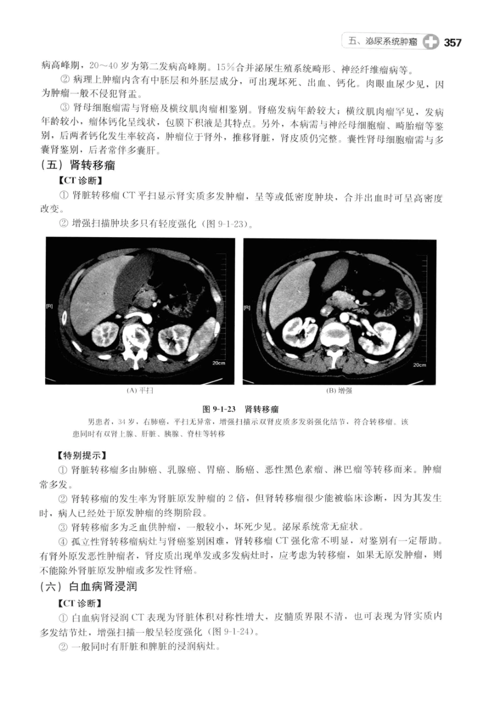 CT读片指南_13200549_370-408.pdf_第1页