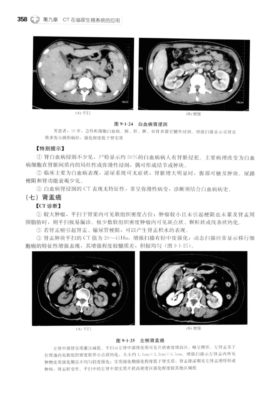 CT读片指南_13200549_370-408.pdf_第2页