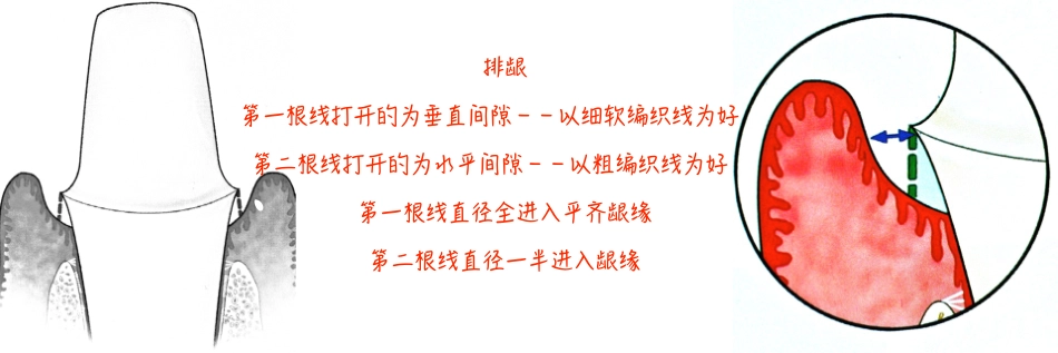 PDF全冠_737-828.pdf_第1页