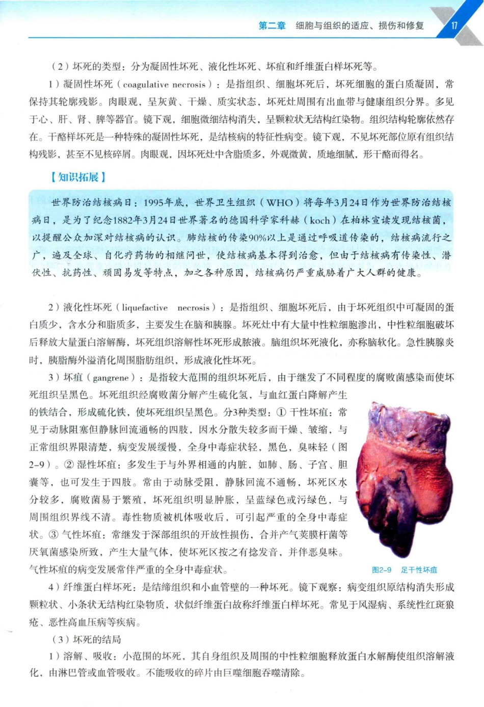 病理学与病理生理学_14314987_31-60.pdf_第2页