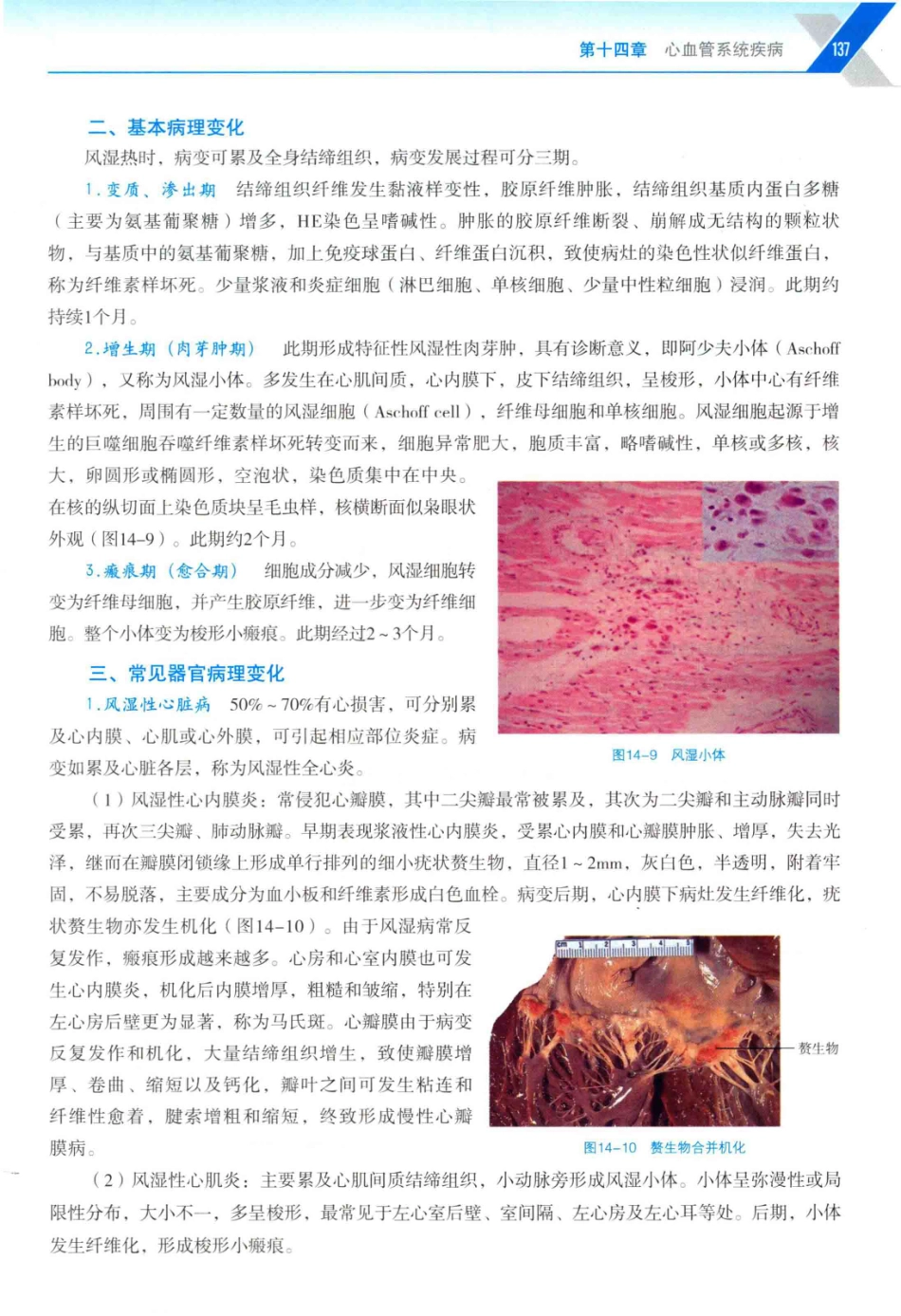 病理学与病理生理学_14314987_151-180.pdf_第2页