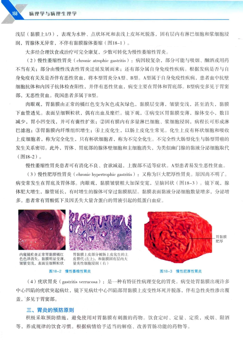 病理学与病理生理学_14314987_181-210.pdf_第3页
