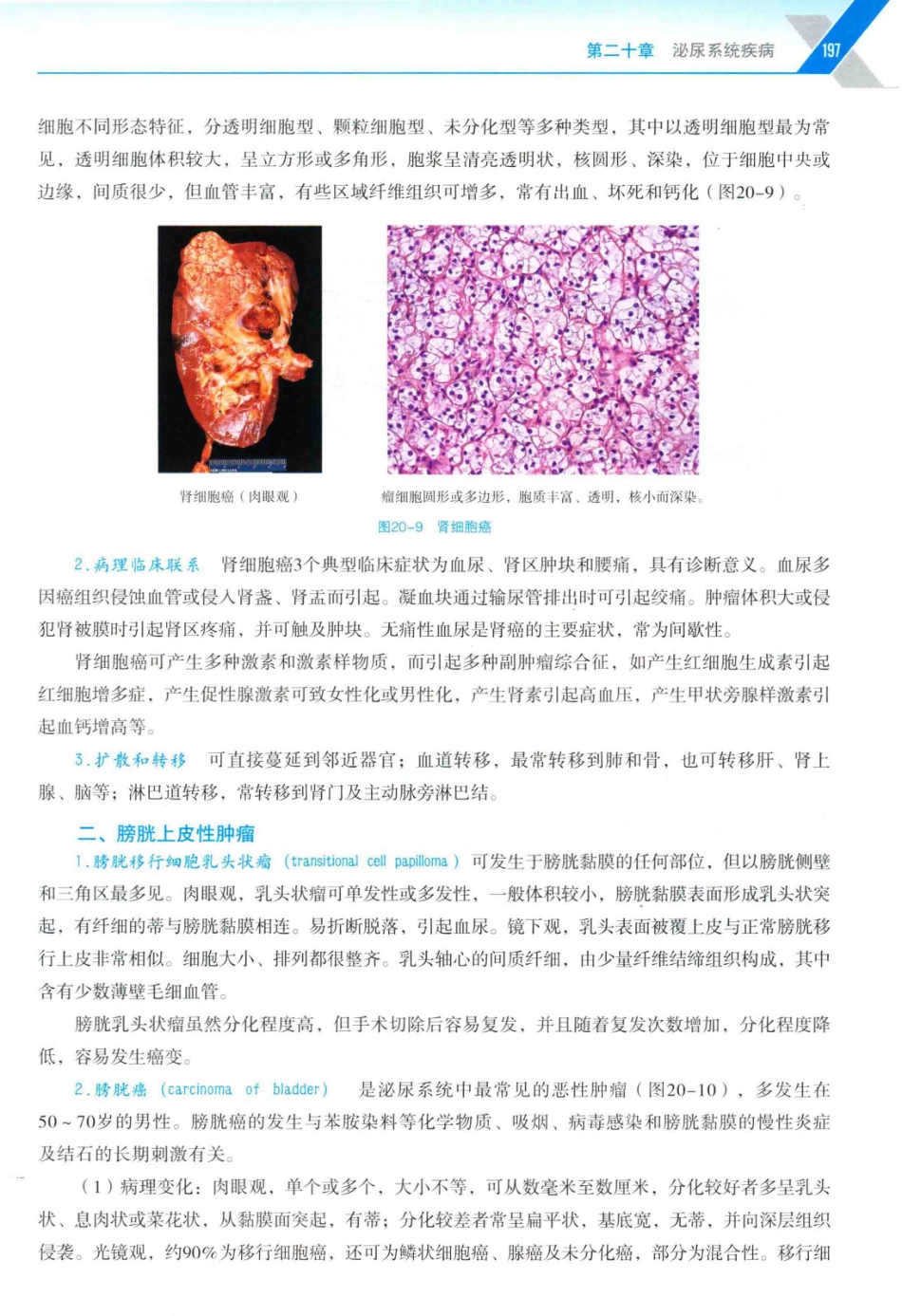 病理学与病理生理学_14314987_211-240.pdf_第2页