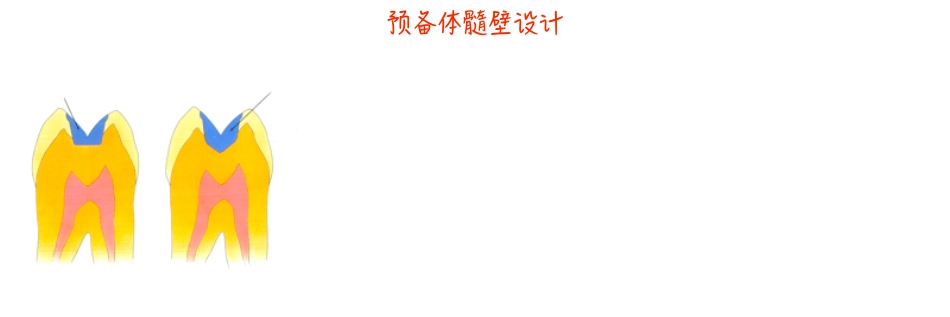 瓷嵌体新课件_321-400.pdf_第2页