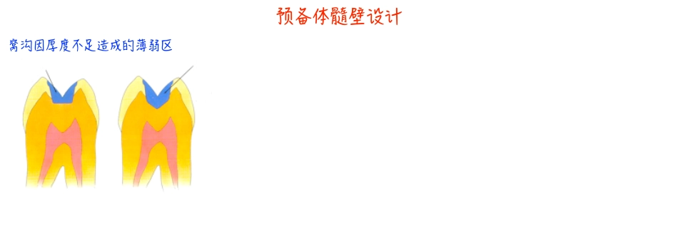 瓷嵌体新课件_321-400.pdf_第3页