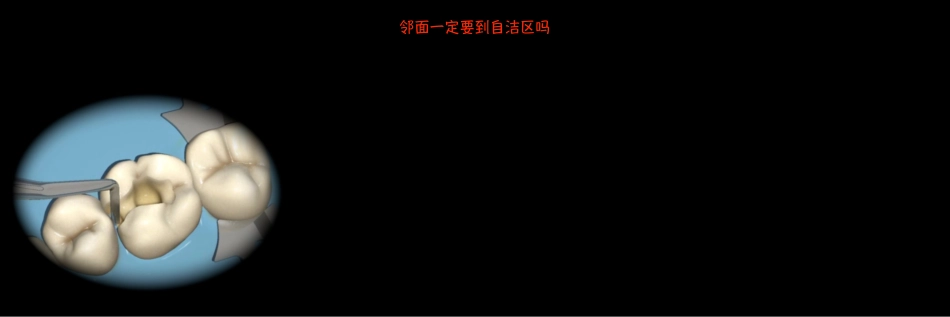 瓷嵌体新课件_401-480.pdf_第3页