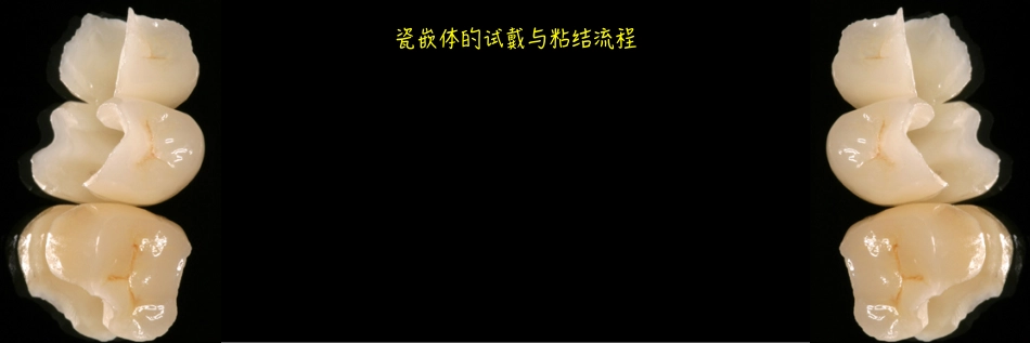 瓷嵌体新课件_721-792.pdf_第2页