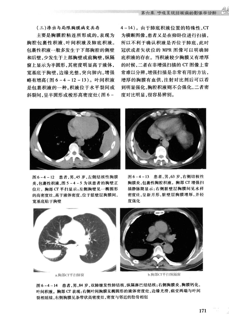 结核病影像学基础_13071936_181-210.pdf_第1页