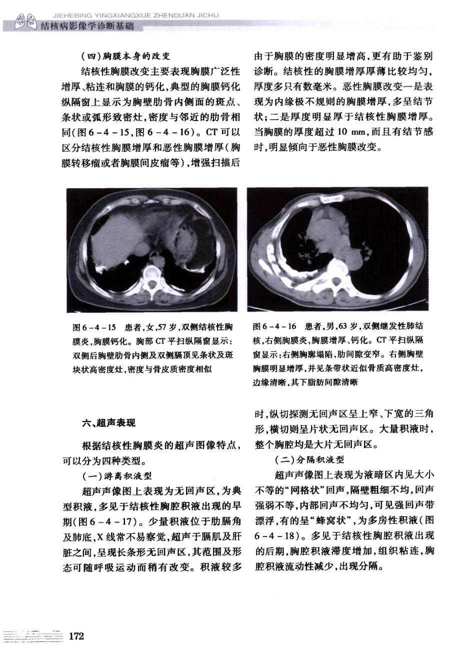 结核病影像学基础_13071936_181-210.pdf_第2页