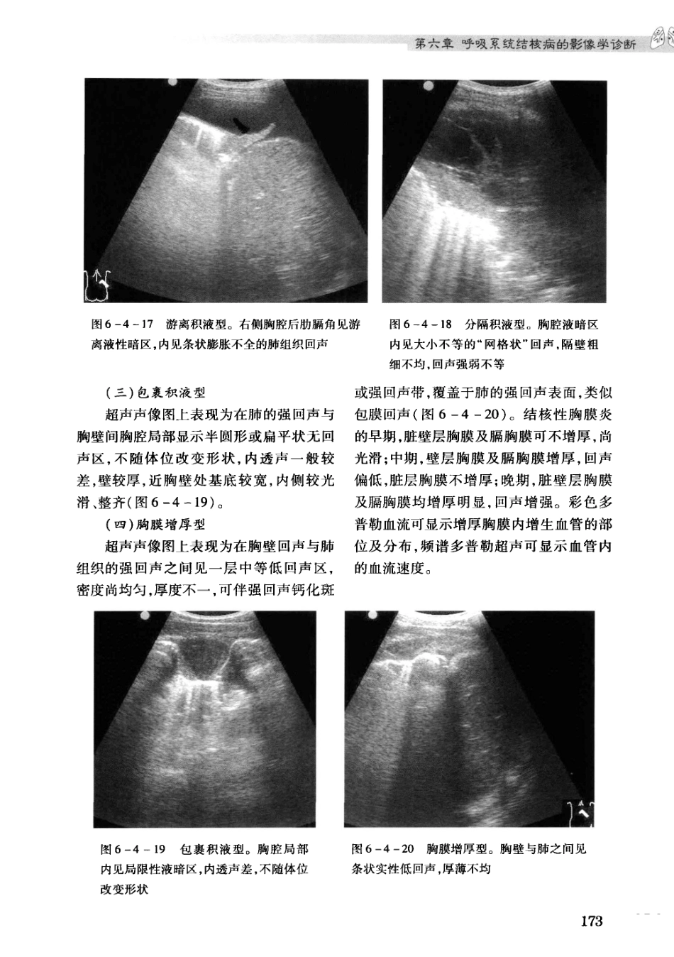 结核病影像学基础_13071936_181-210.pdf_第3页