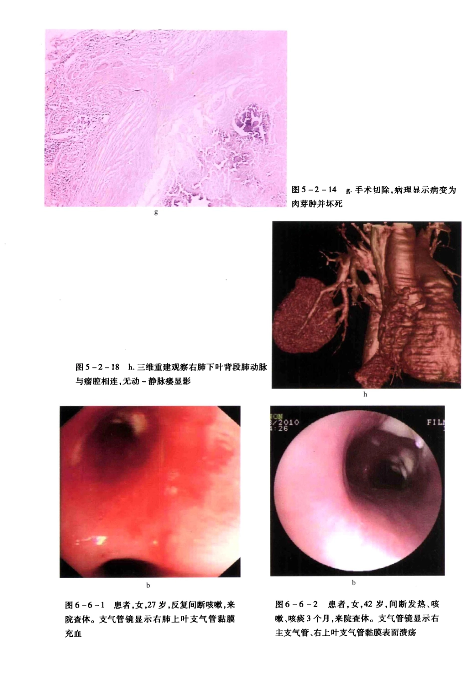 结核病影像学基础_13071936_271-280.pdf_第1页