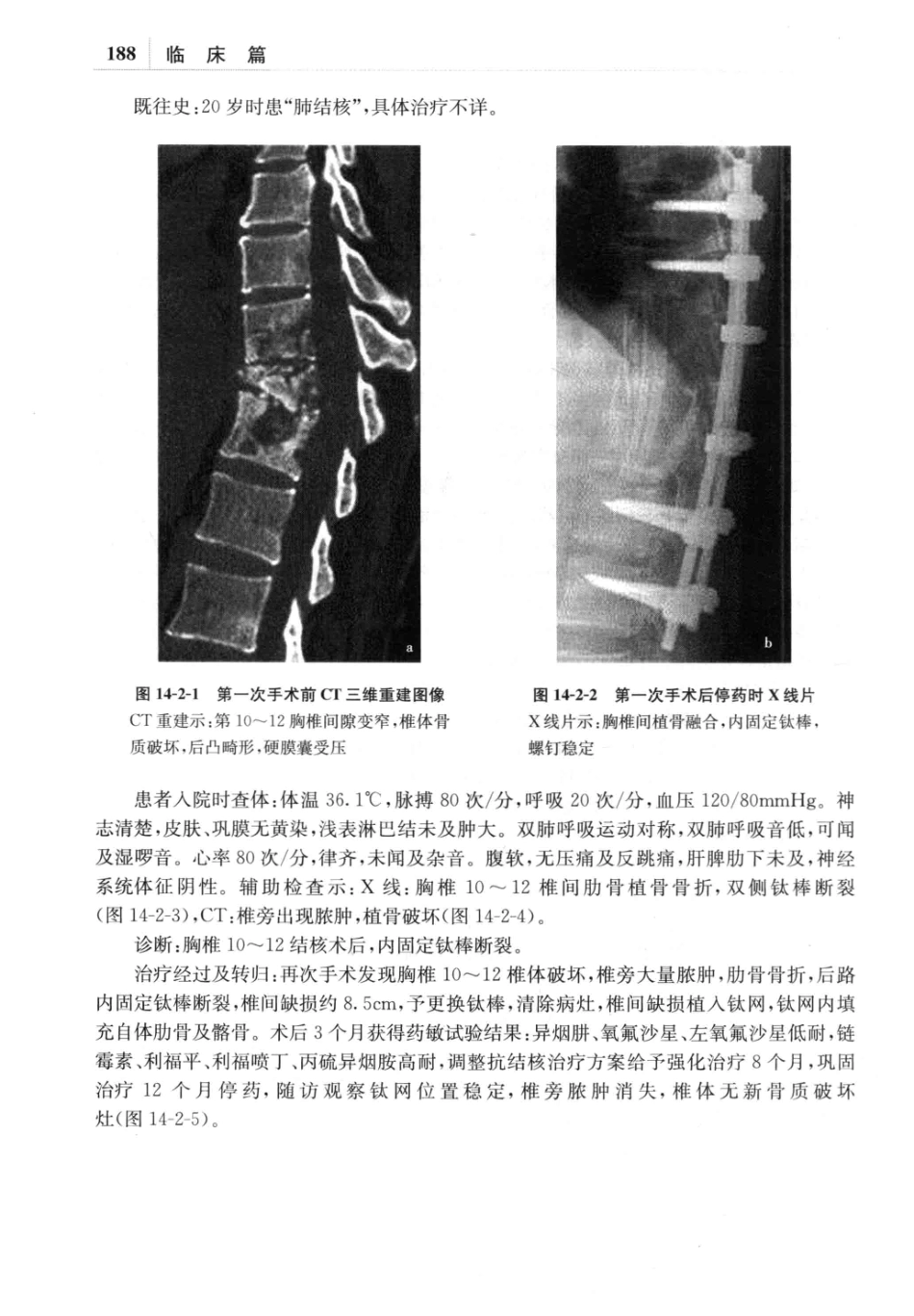 耐药结核病学_13642687_201-240.pdf_第1页