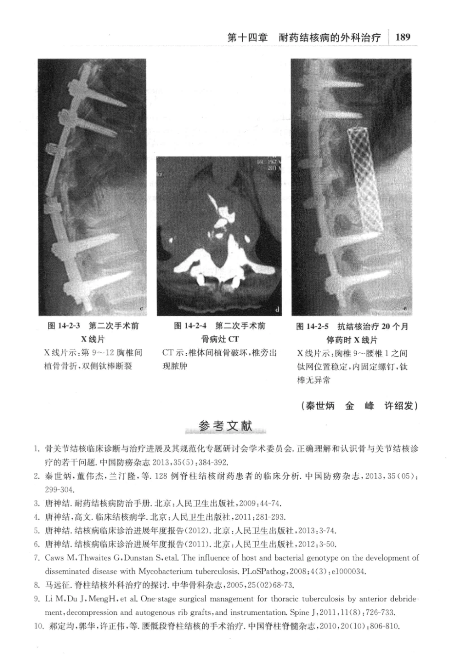 耐药结核病学_13642687_201-240.pdf_第2页