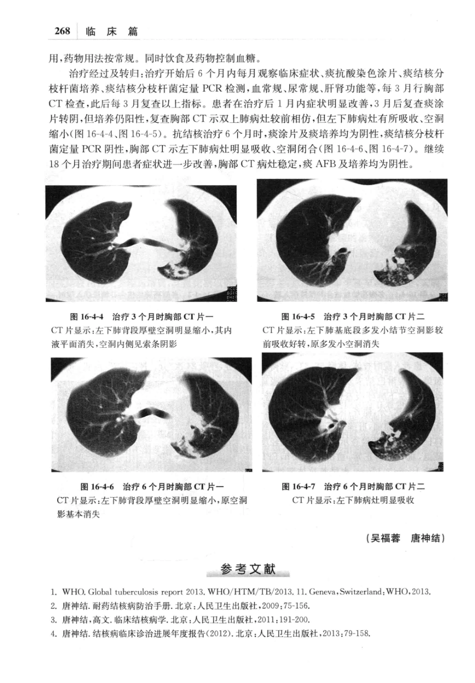耐药结核病学_13642687_281-320.pdf_第1页