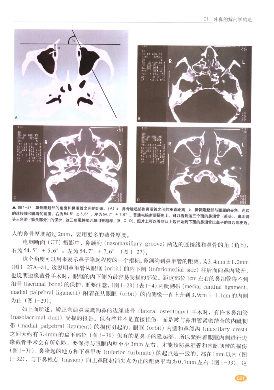 现代韩国鼻整形术_21-40.pdf_第2页