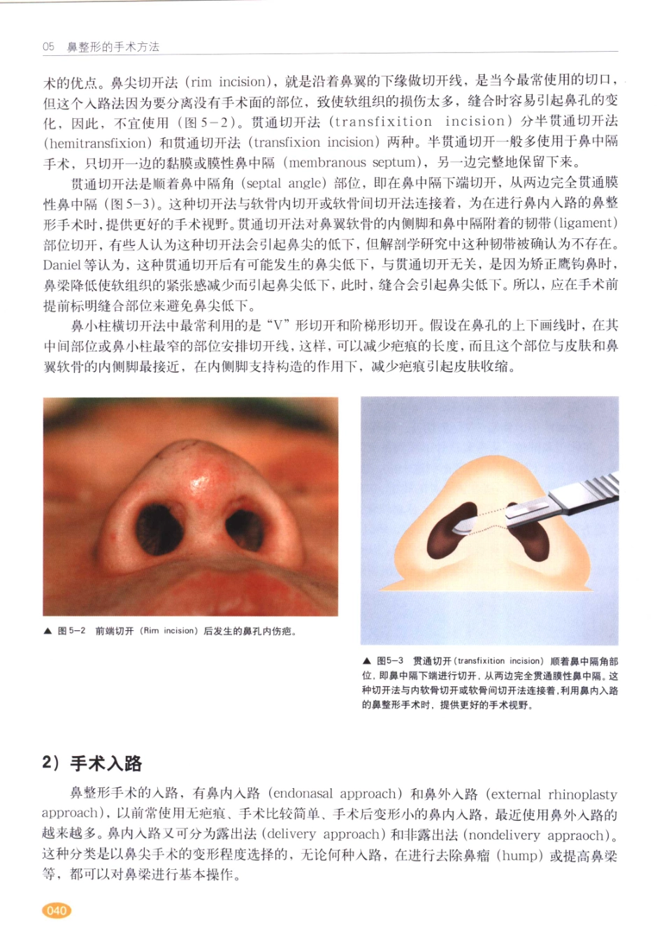 现代韩国鼻整形术_41-60.pdf_第1页