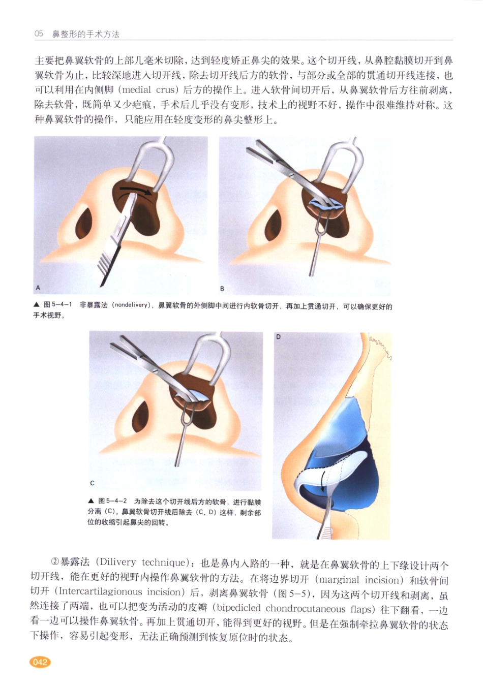 现代韩国鼻整形术_41-60.pdf_第3页