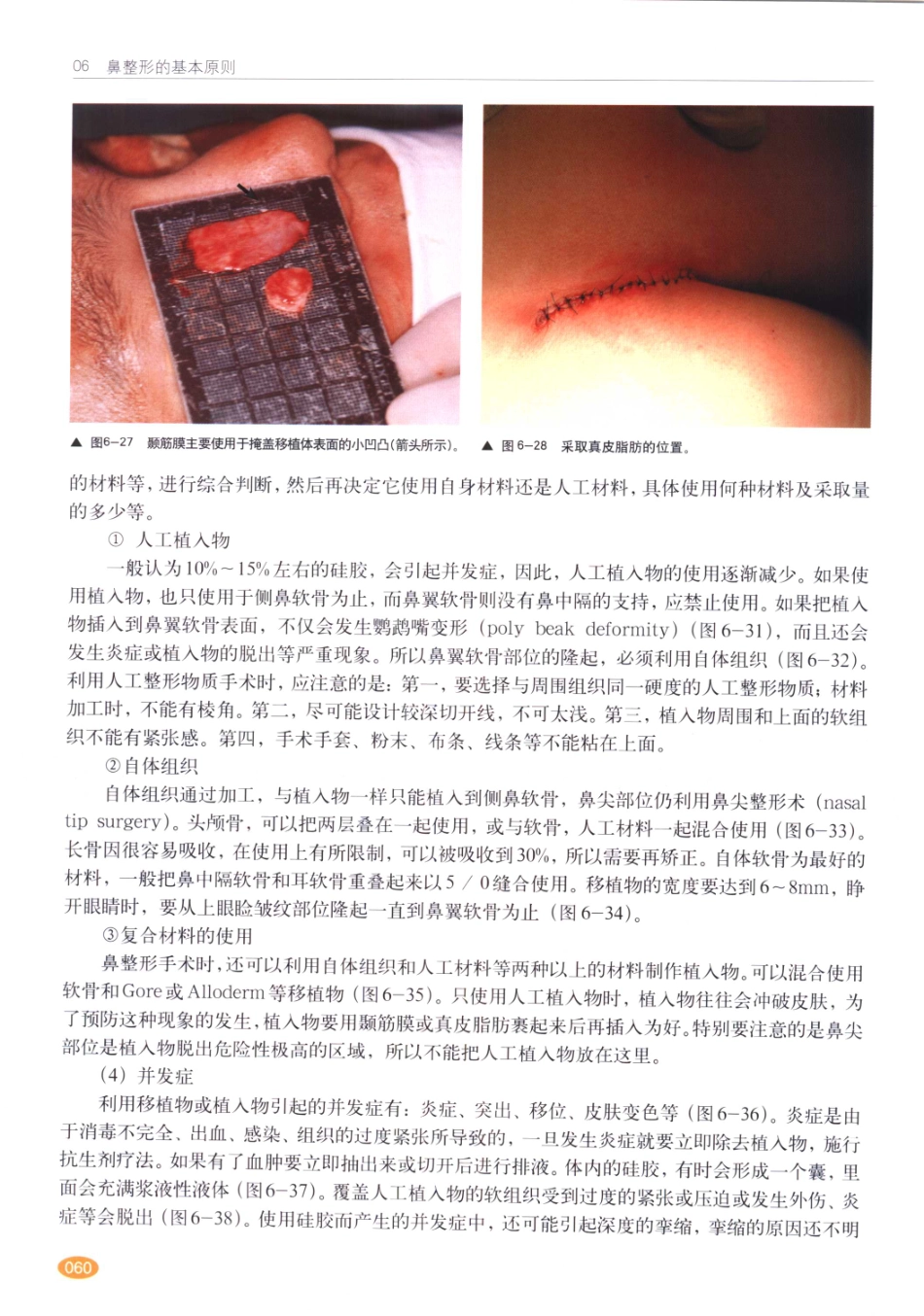现代韩国鼻整形术_61-80.pdf_第1页