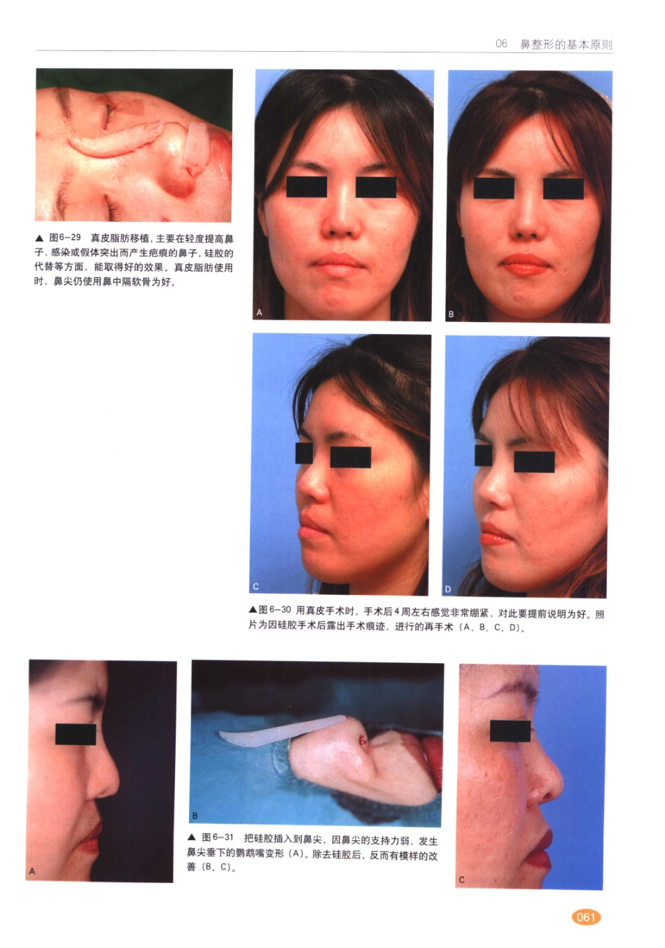 现代韩国鼻整形术_61-80.pdf_第2页