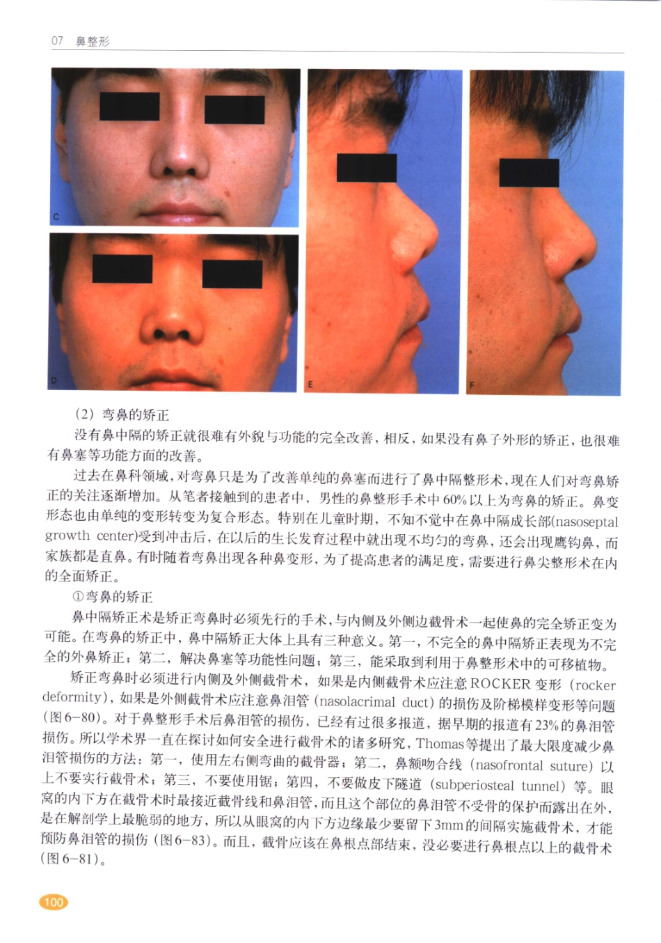 现代韩国鼻整形术_101-120.pdf_第1页