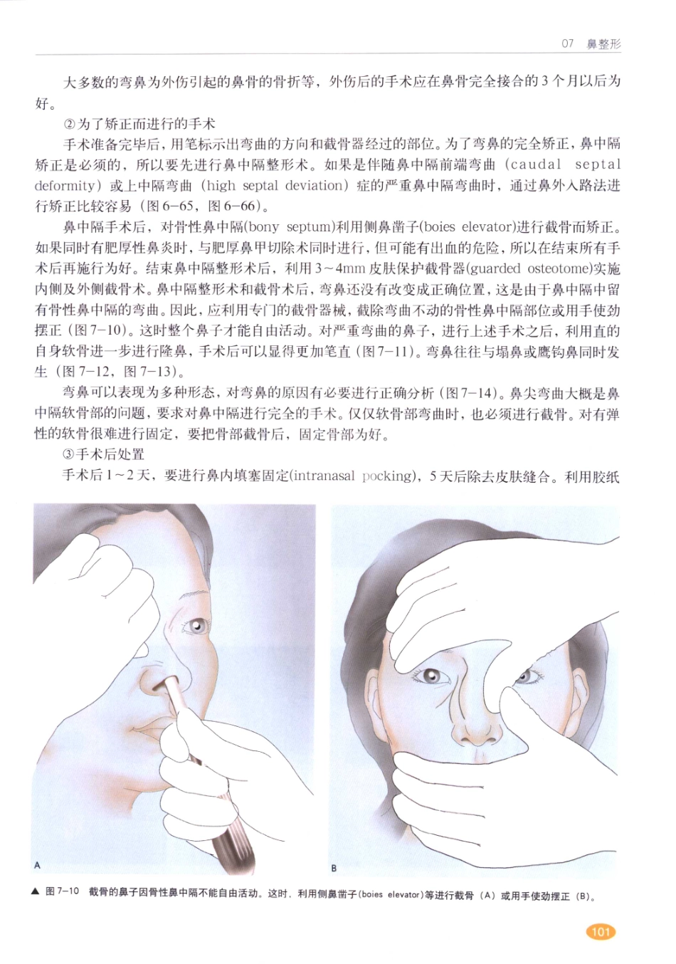 现代韩国鼻整形术_101-120.pdf_第2页