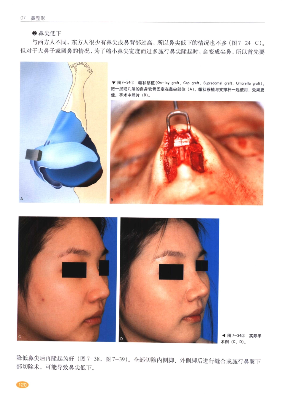 现代韩国鼻整形术_121-140.pdf_第1页