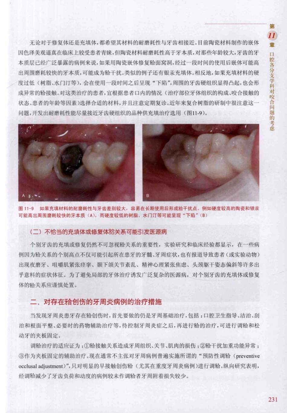 牙合学理论与临床实践 第2版_韩科，张豪主编2014（彩图）_241-270.pdf_第3页