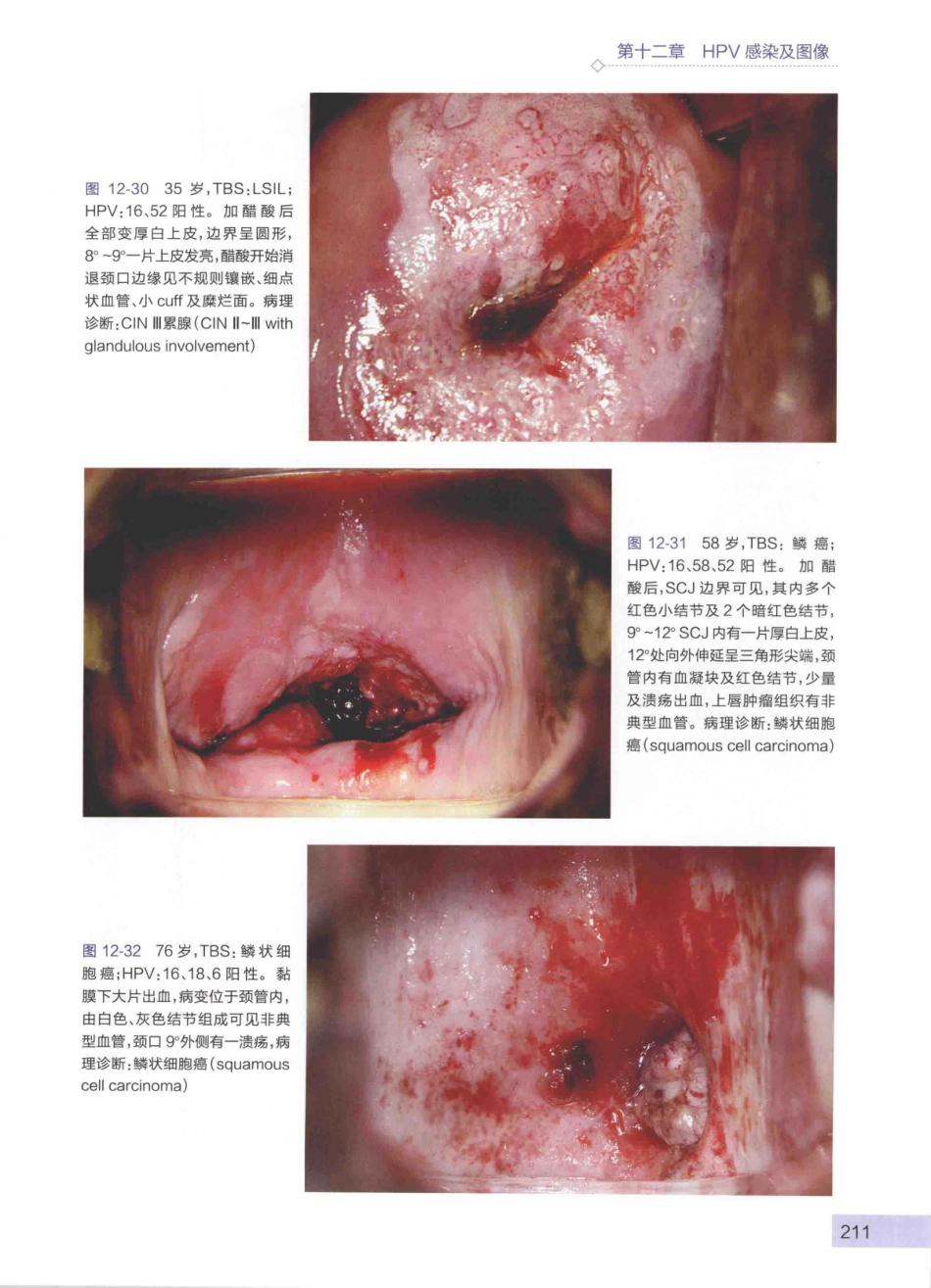 阴道镜图谱  第3版_14003389_226-270.pdf_第1页