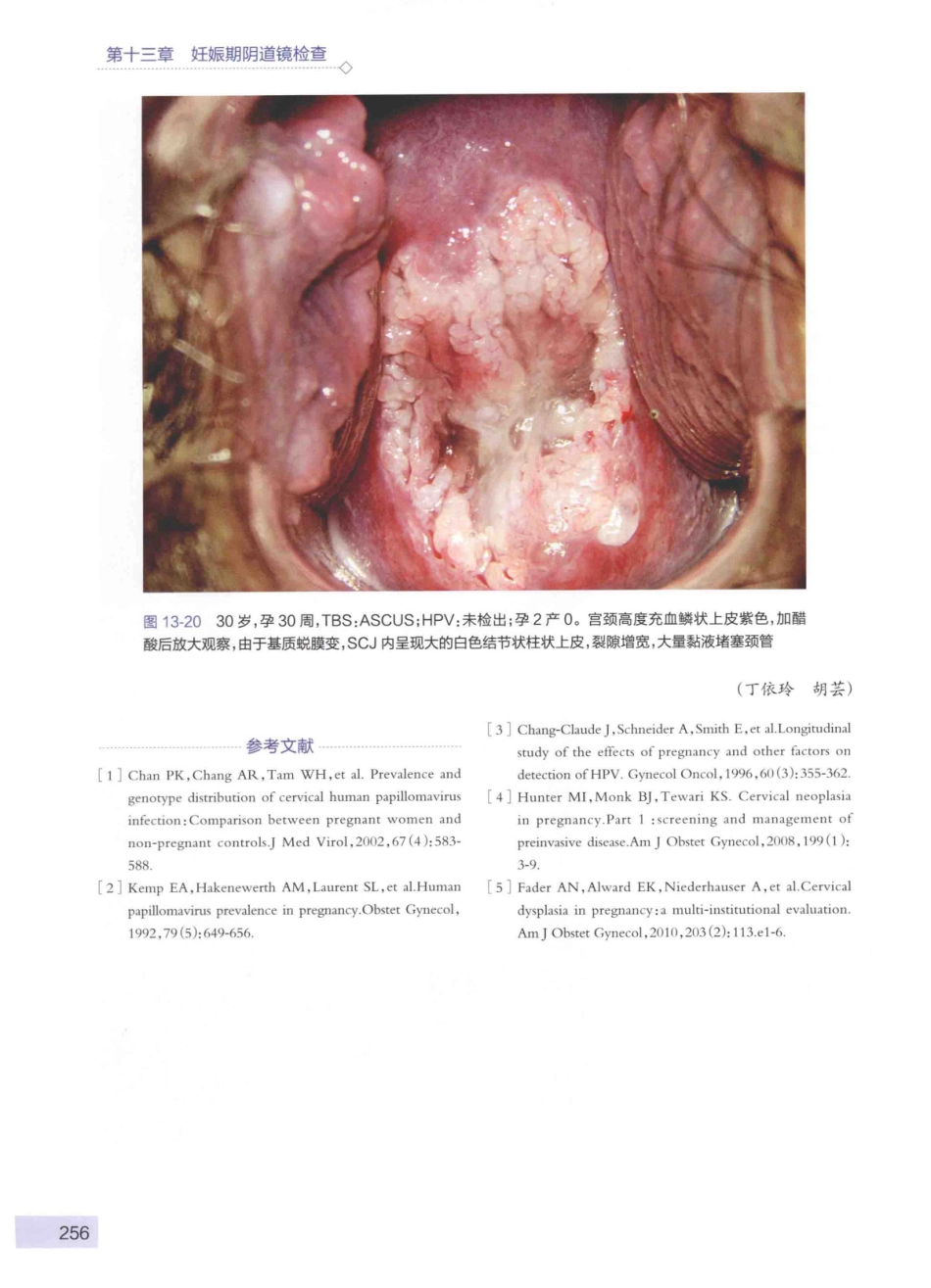 阴道镜图谱  第3版_14003389_271-315.pdf_第1页