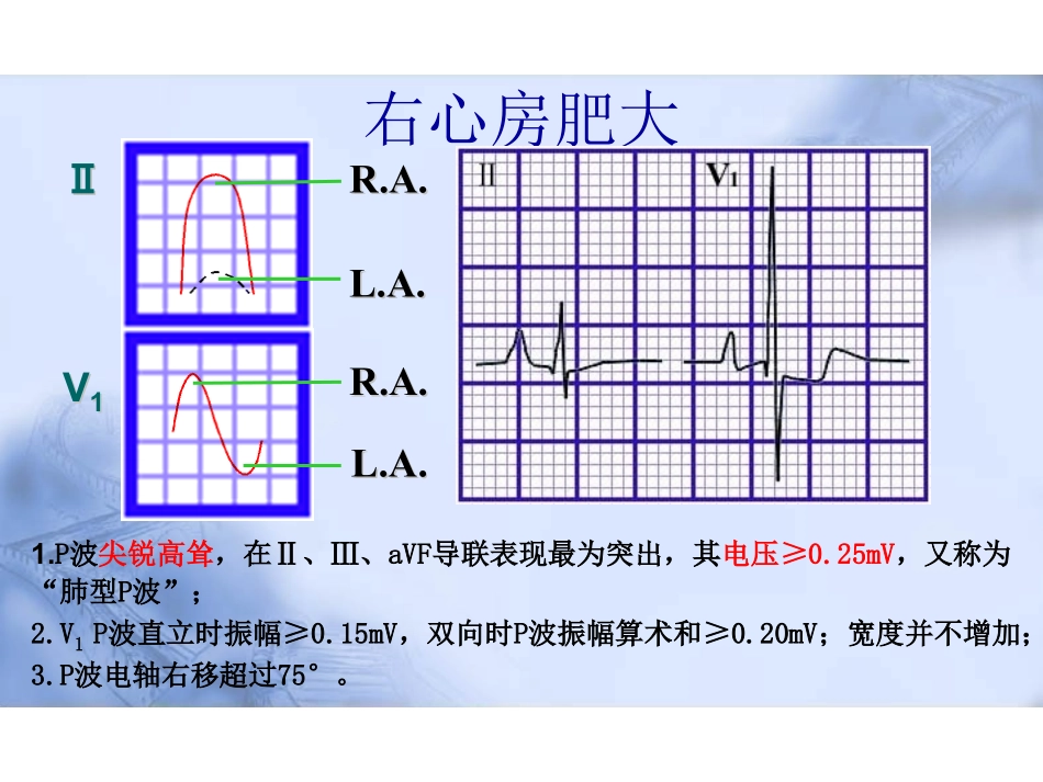 医学：心电图.2附二院.pdf_第3页