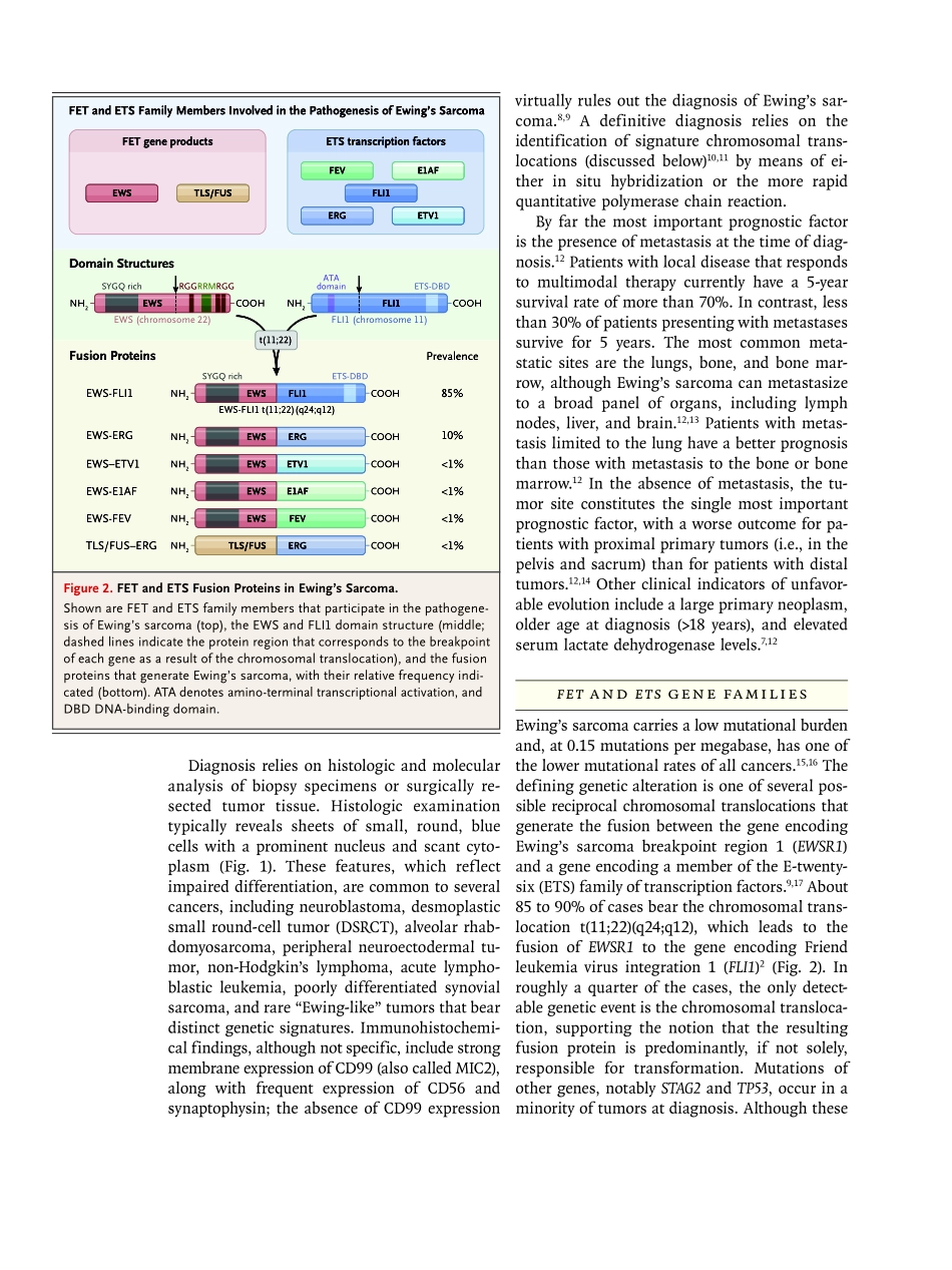 医学：尤文氏肉瘤 Ewing’s Sarcoma.pdf_第3页