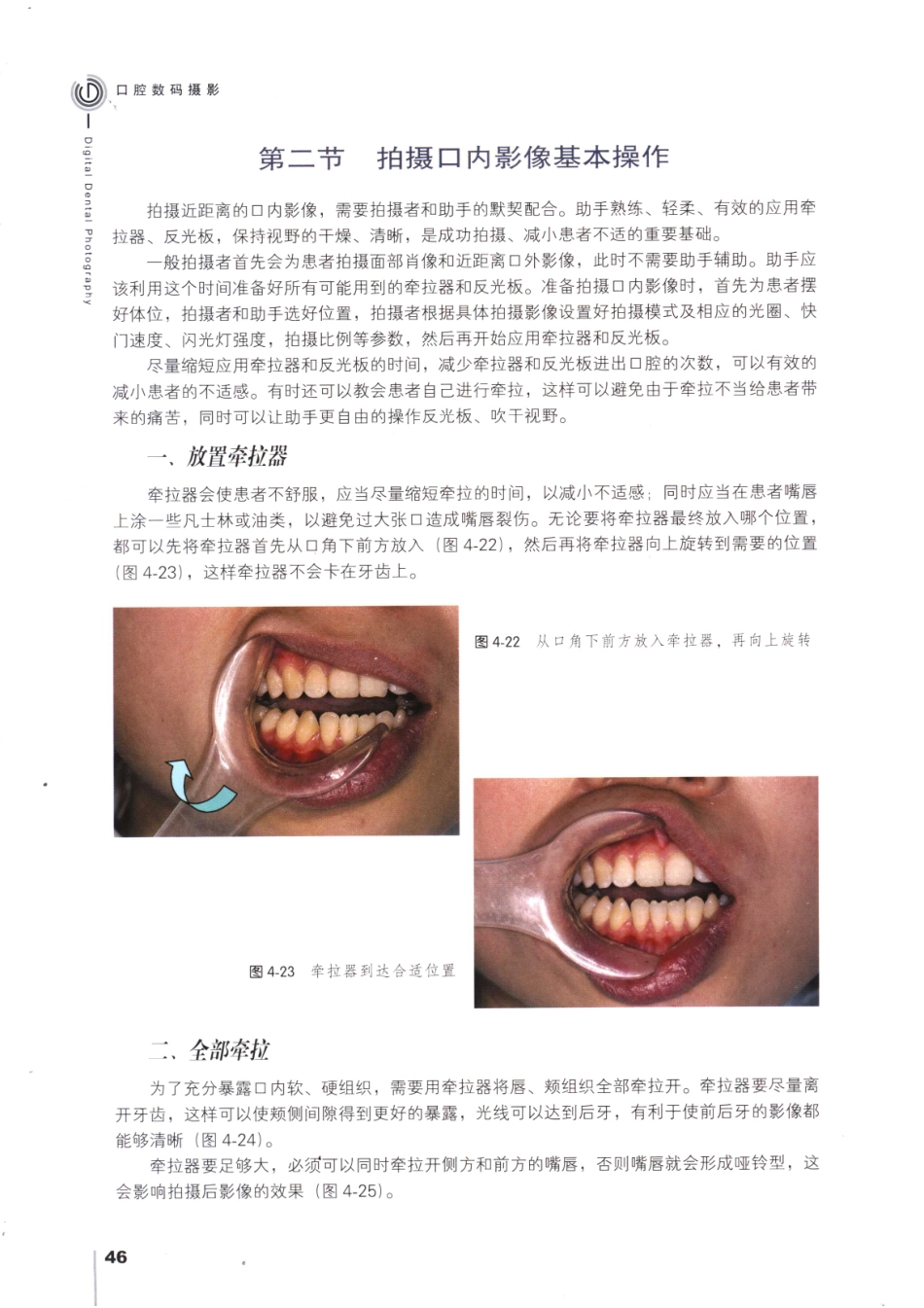 008口腔数码摄影_61-90.pdf_第1页