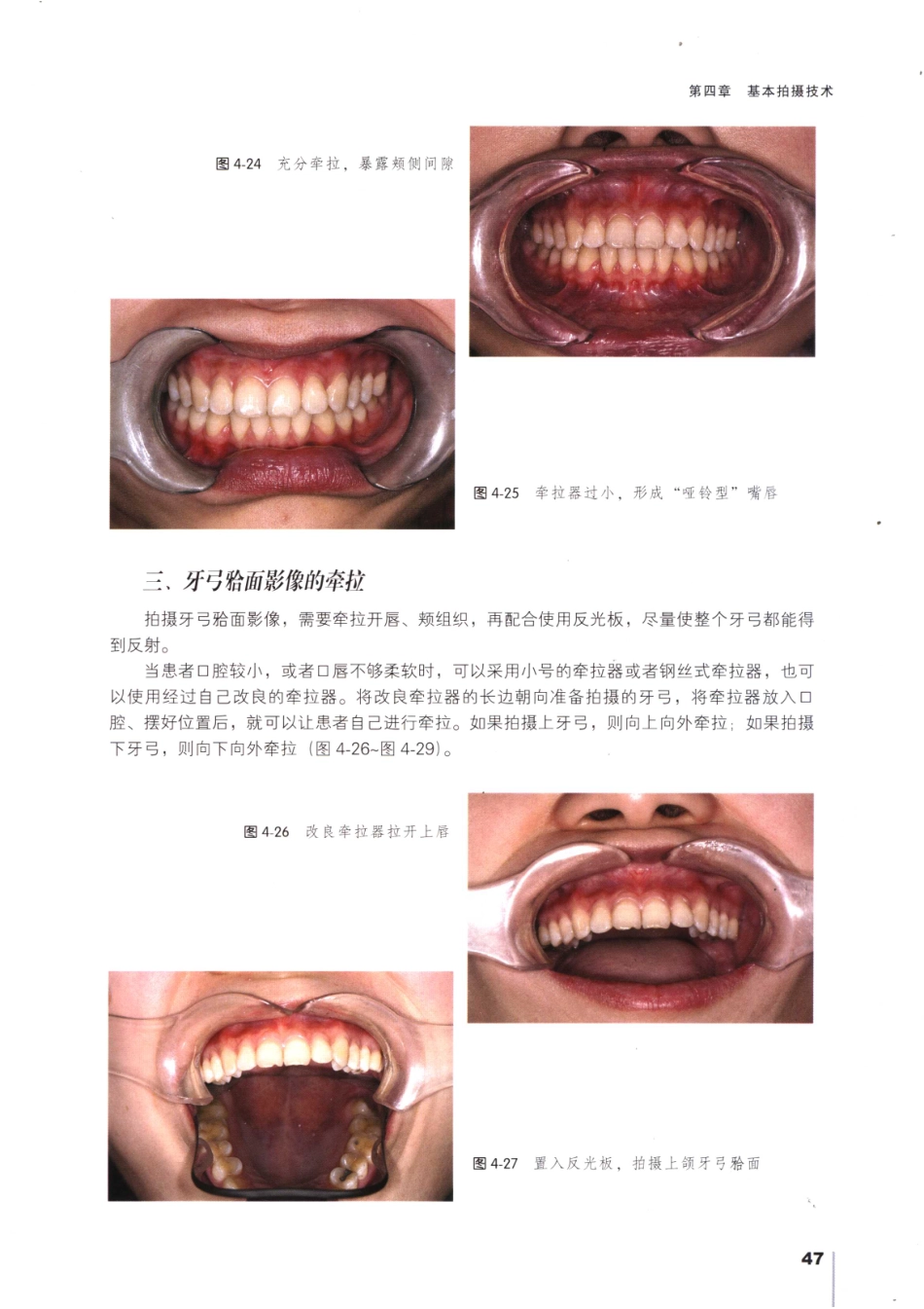 008口腔数码摄影_61-90.pdf_第2页