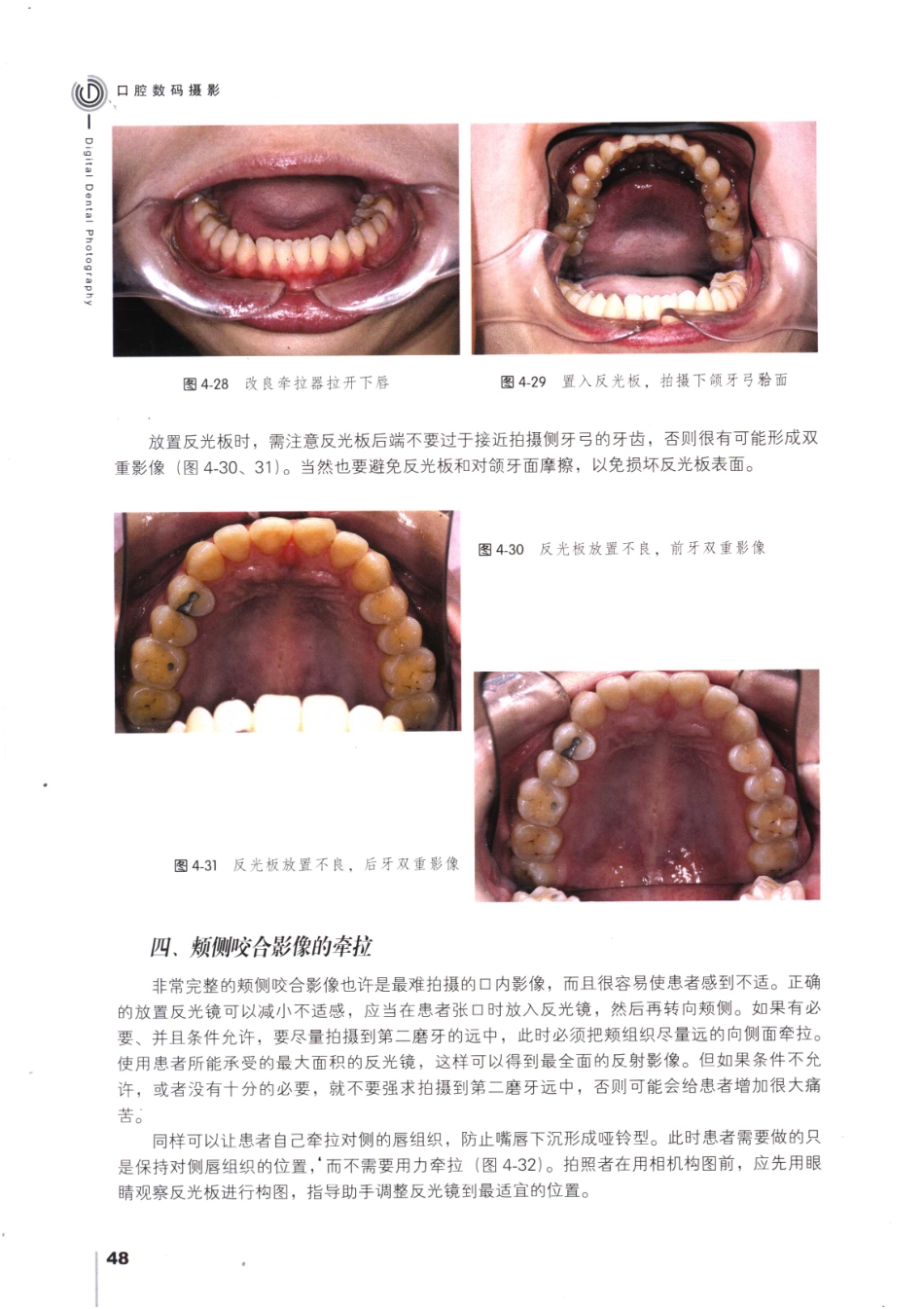 008口腔数码摄影_61-90.pdf_第3页