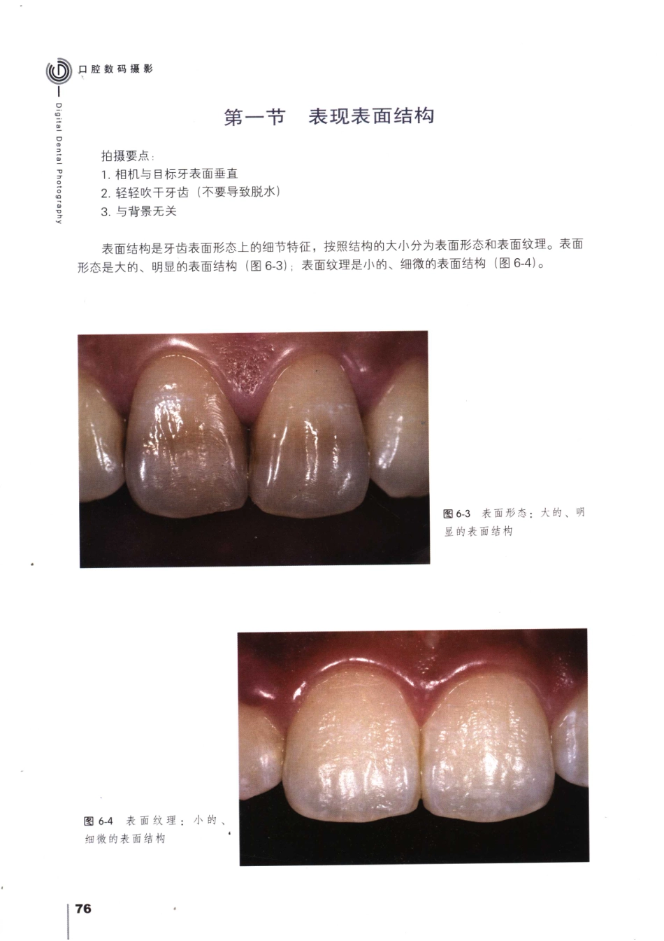 008口腔数码摄影_91-120.pdf_第1页