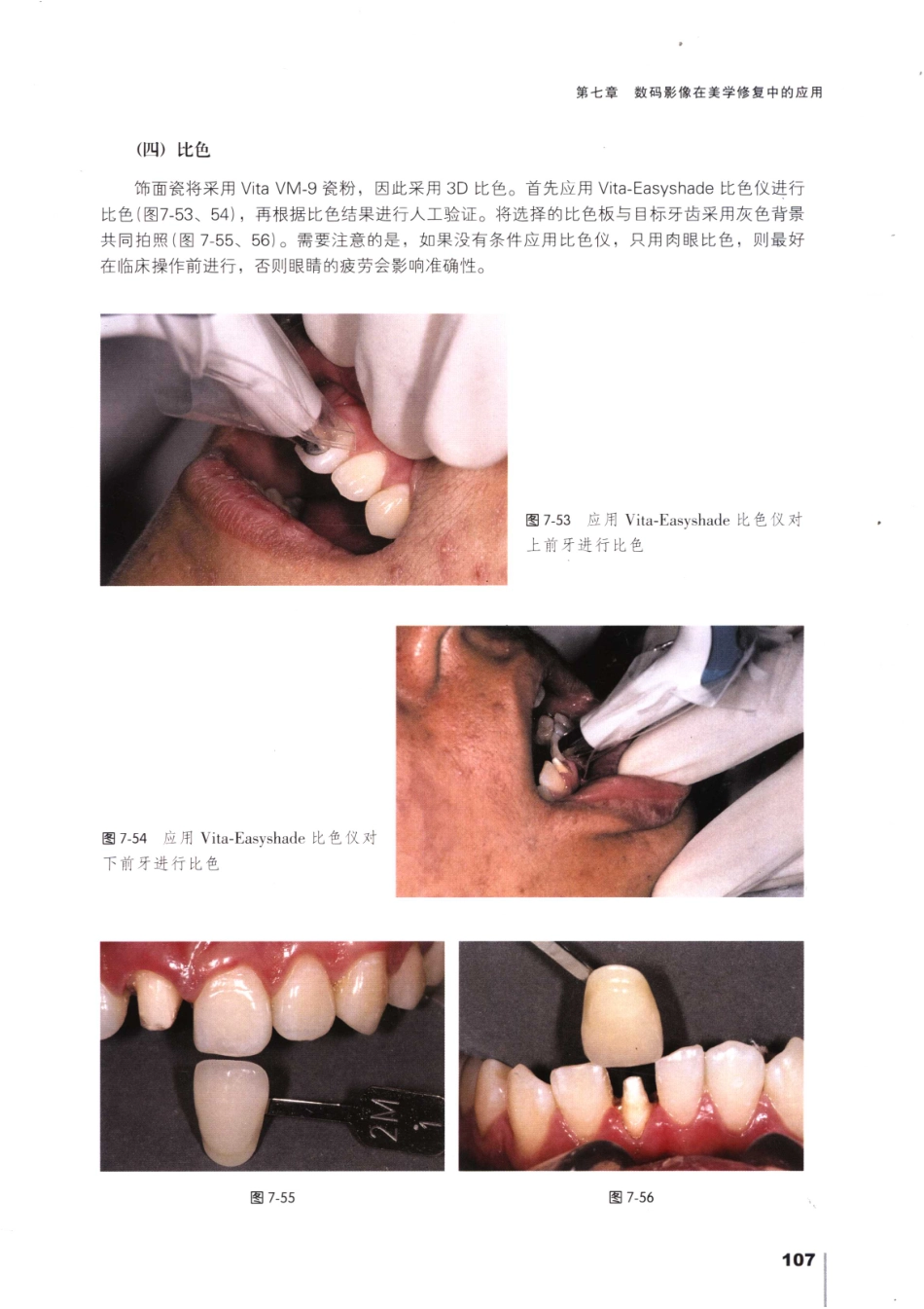 008口腔数码摄影_121-150.pdf_第2页