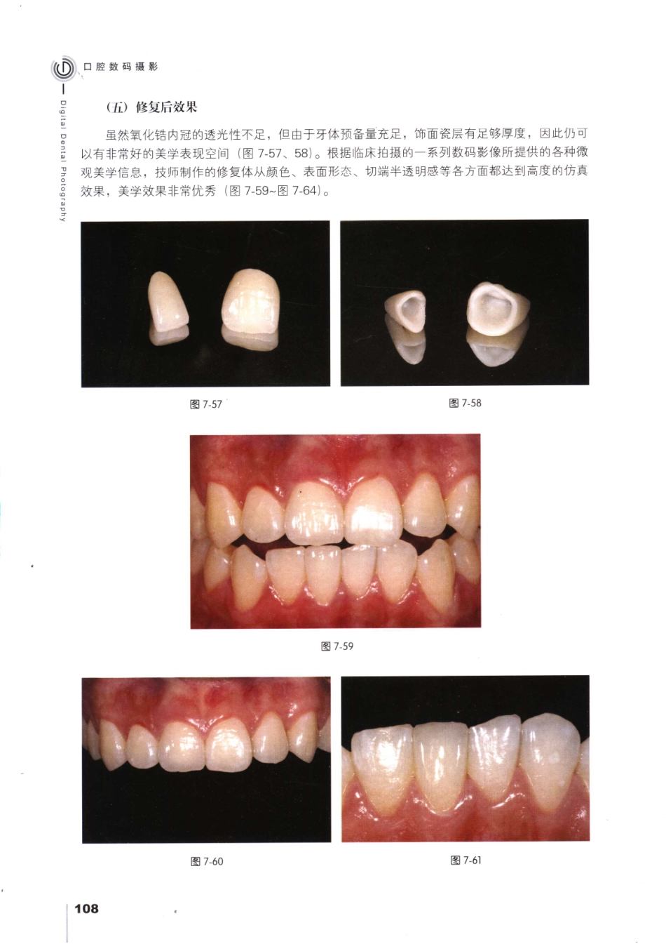 008口腔数码摄影_121-150.pdf_第3页