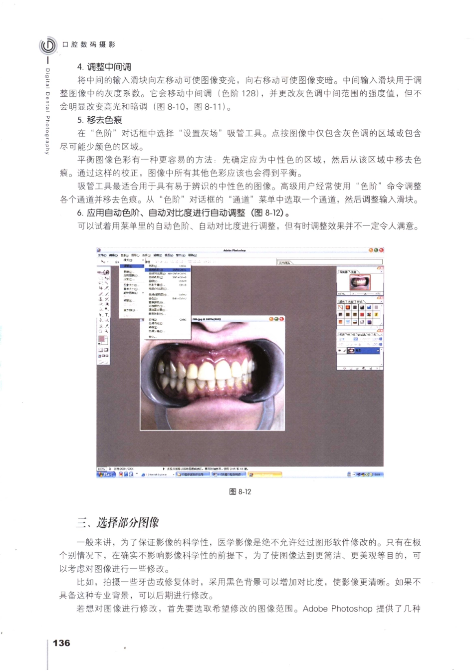 008口腔数码摄影_151-168.pdf_第1页
