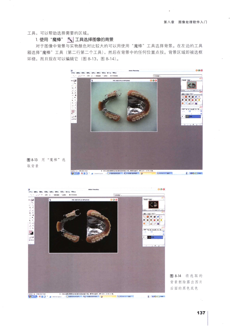 008口腔数码摄影_151-168.pdf_第2页