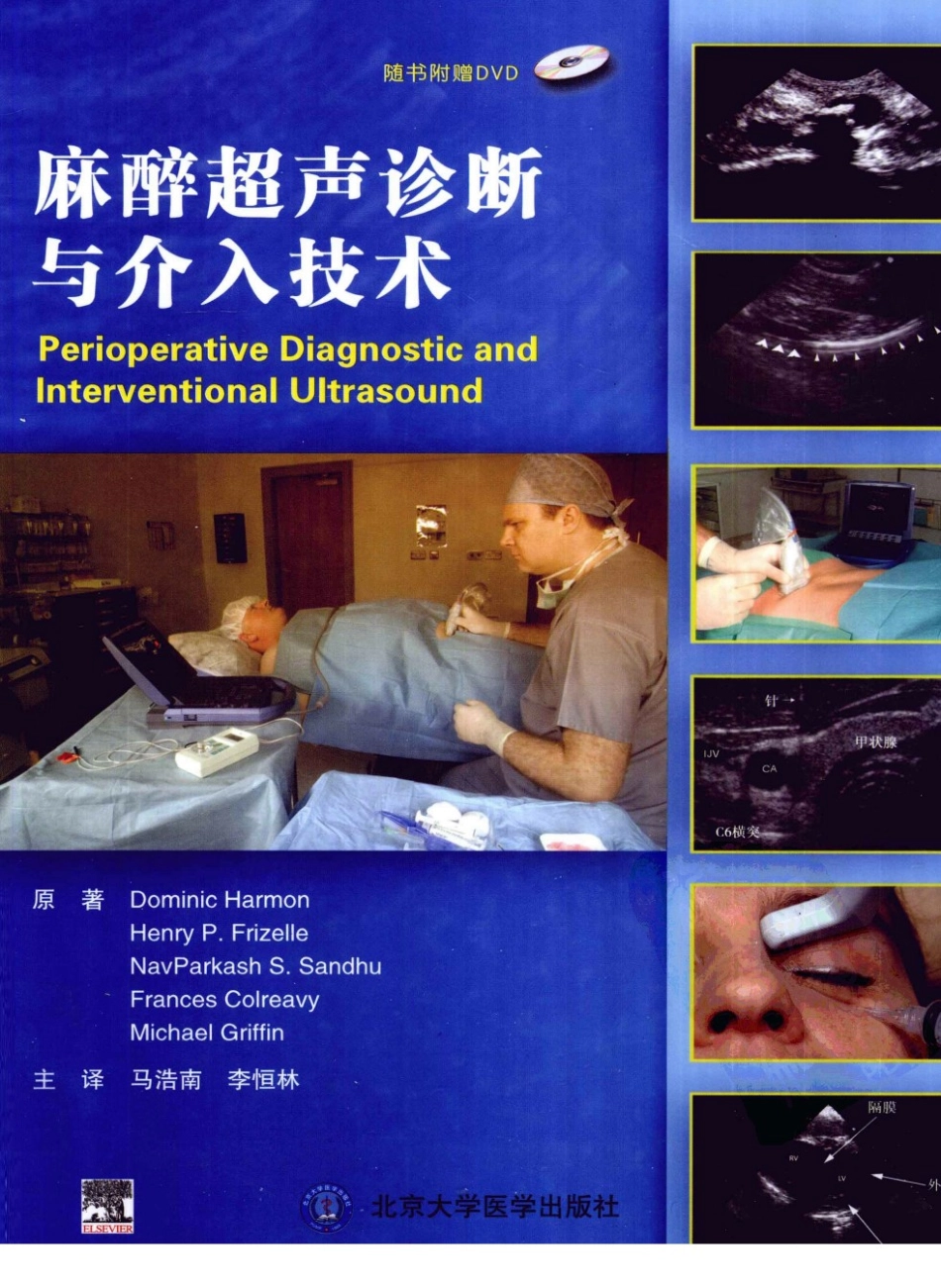 B超麻醉超声11-0_1-40.pdf_第1页