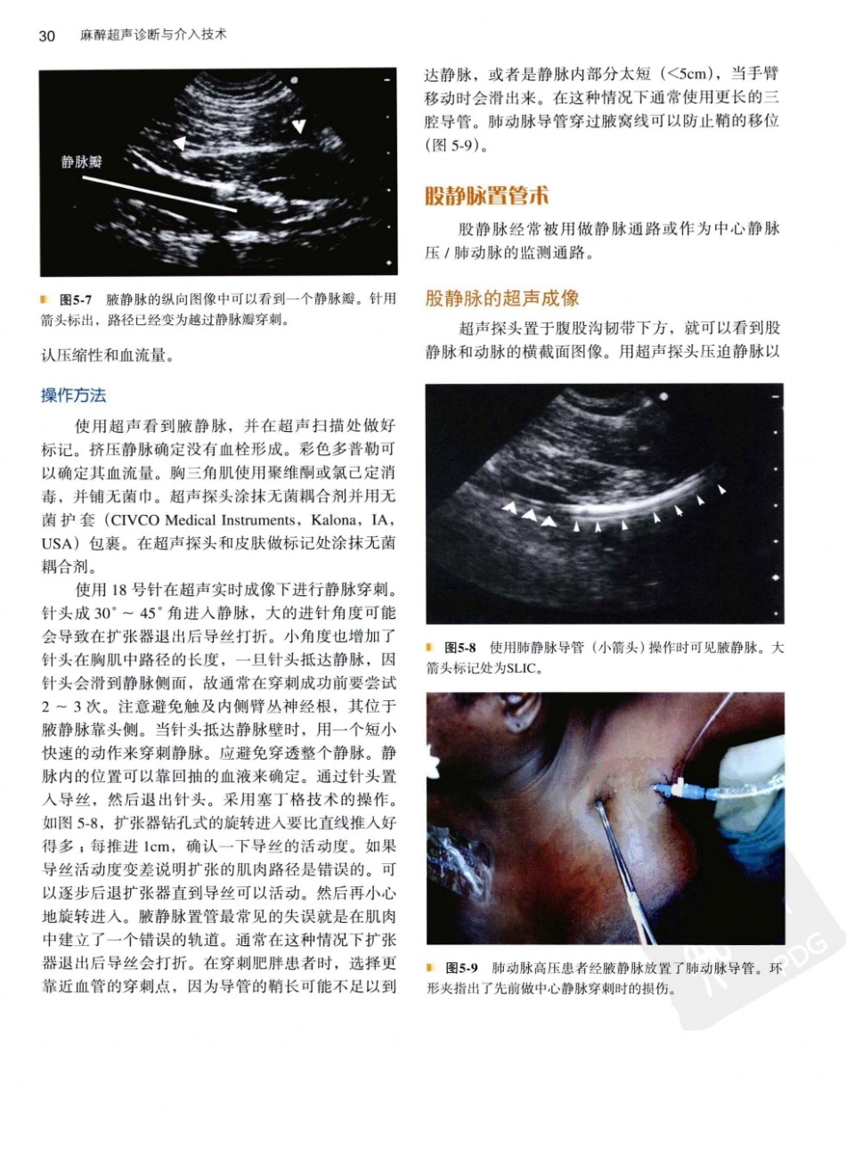 B超麻醉超声11-0_41-80.pdf_第1页