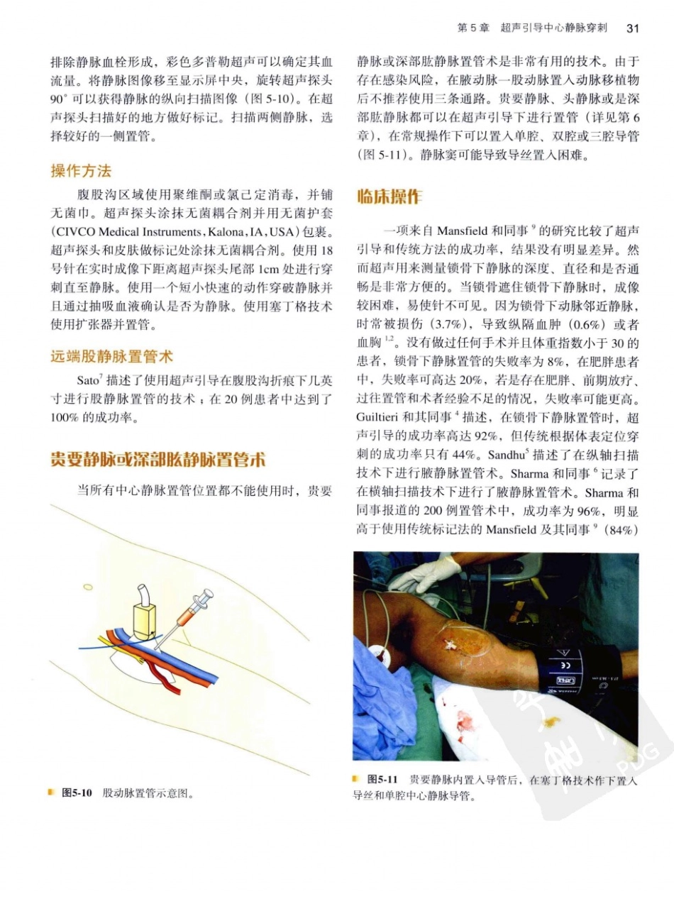 B超麻醉超声11-0_41-80.pdf_第2页