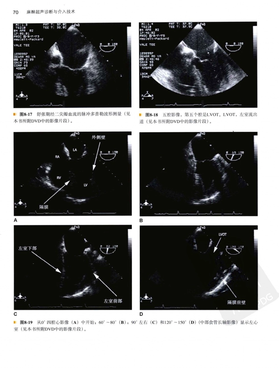 B超麻醉超声11-0_81-120.pdf_第1页